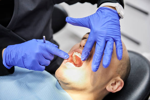 Best Emergency Tooth Extraction in Meggett, SC